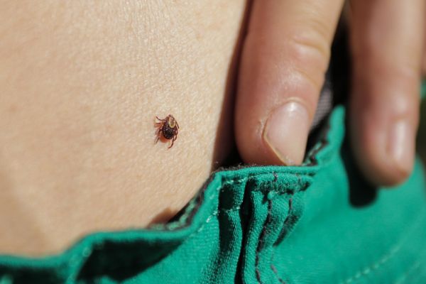 blacklegged tick on a human body 